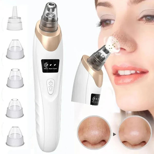 5-in-1 Blackhead Remover Vacuum – Rechargeable Facial Pore Cleaner