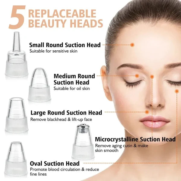 5-in-1 Blackhead Remover Vacuum – Rechargeable Facial Pore Cleaner