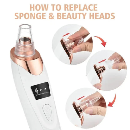5-in-1 Blackhead Remover Vacuum – Rechargeable Facial Pore Cleaner