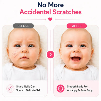 Baby Electric Nail Trimmer – Safe Nail Cutter & File Kit for Newborns
